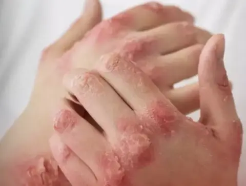 DIOS SANTO, acaba de aparece una batería devoradora de carne