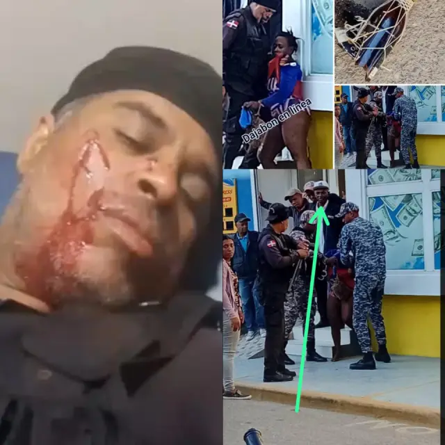 hiere a agente de la Policía Municipal en Dajabón
