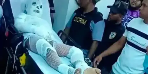 Hombre prende fuego a su hermano tras discusión
